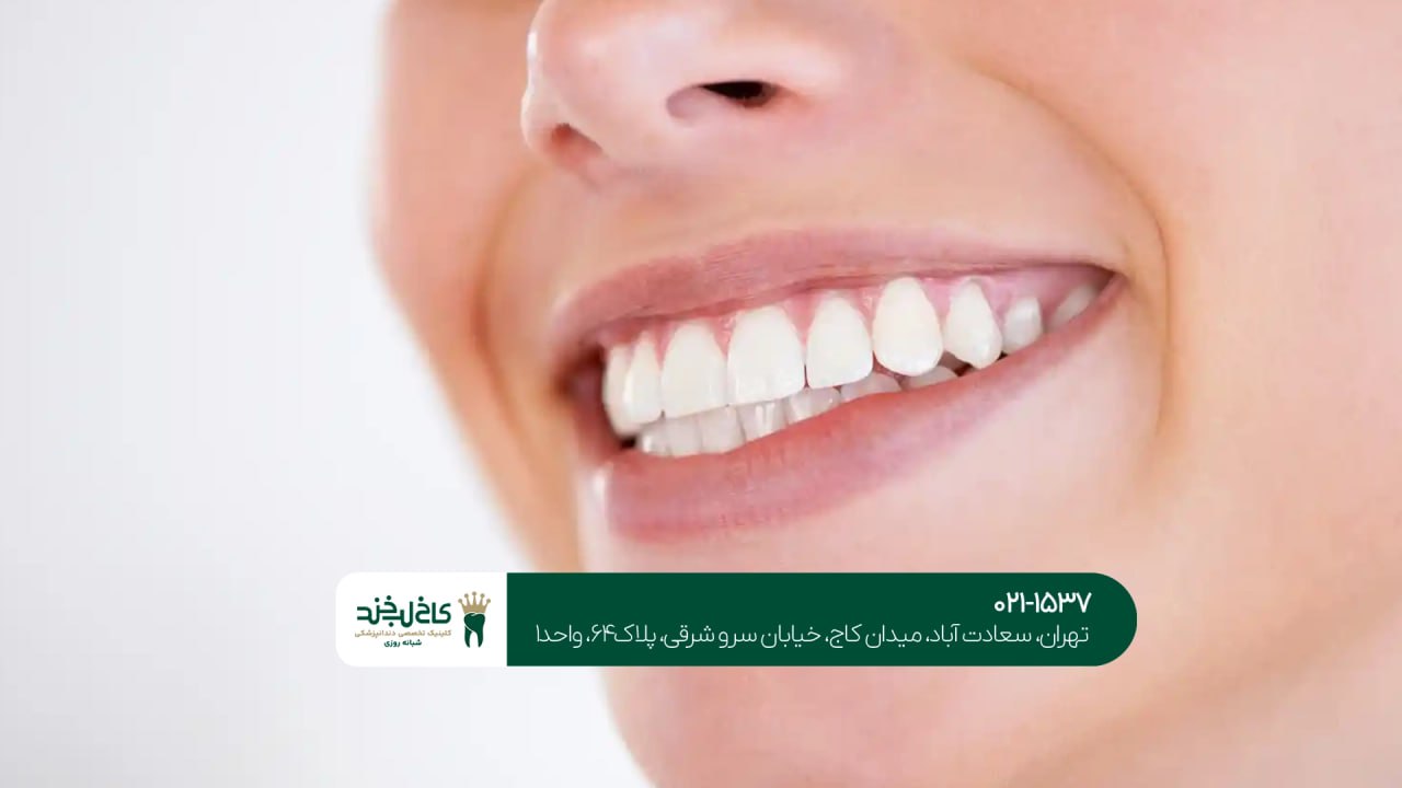 دندانپزشکی زیبایی در تهران