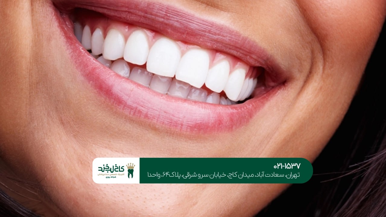 بهترین کلینیک طراحی لبخند