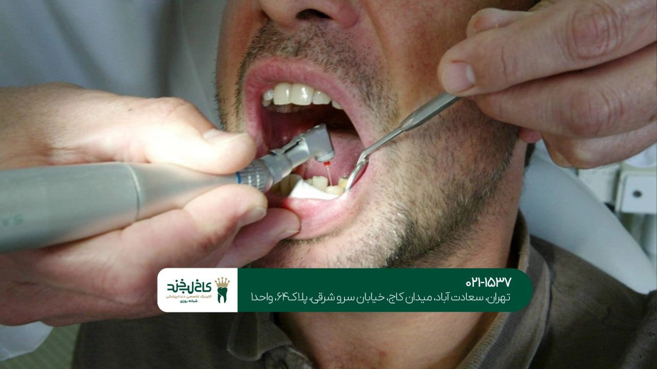 دندانپزشکی با قیمت مناسب در تهران