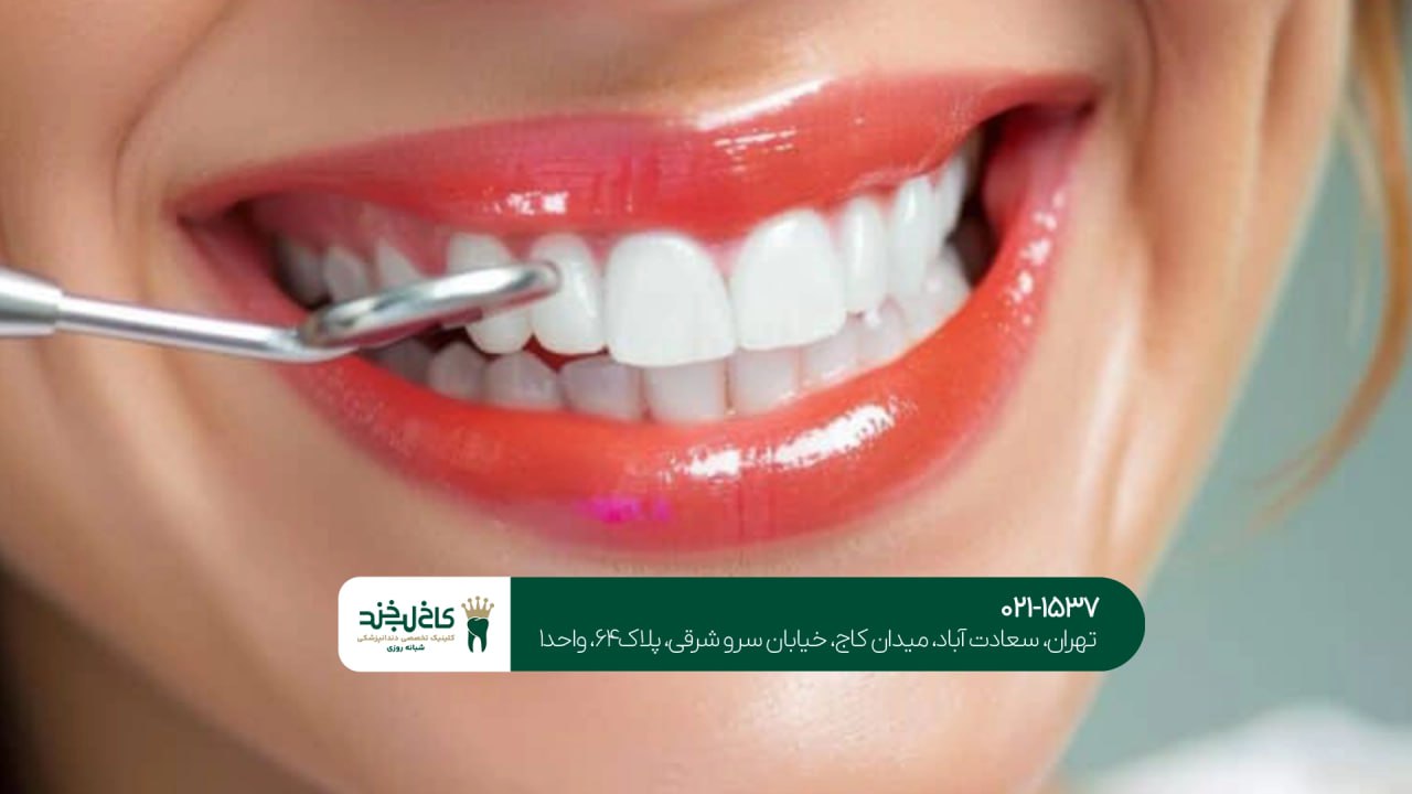 دندانپزشکی حرفهای زیبایی