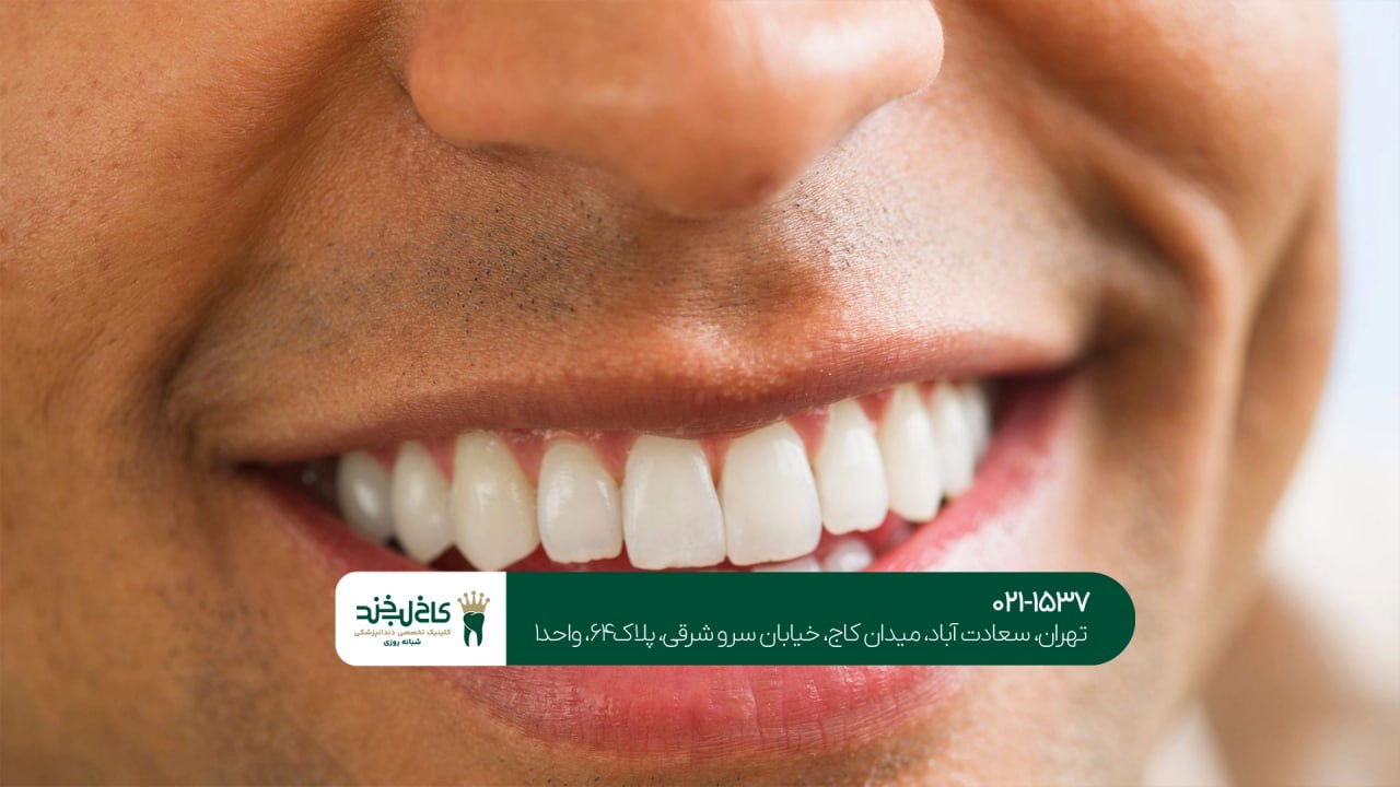 متخصص زیبایی لبخند