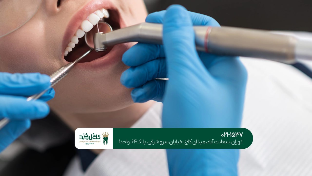 دندانپزشک زیبایی خوب در تهران