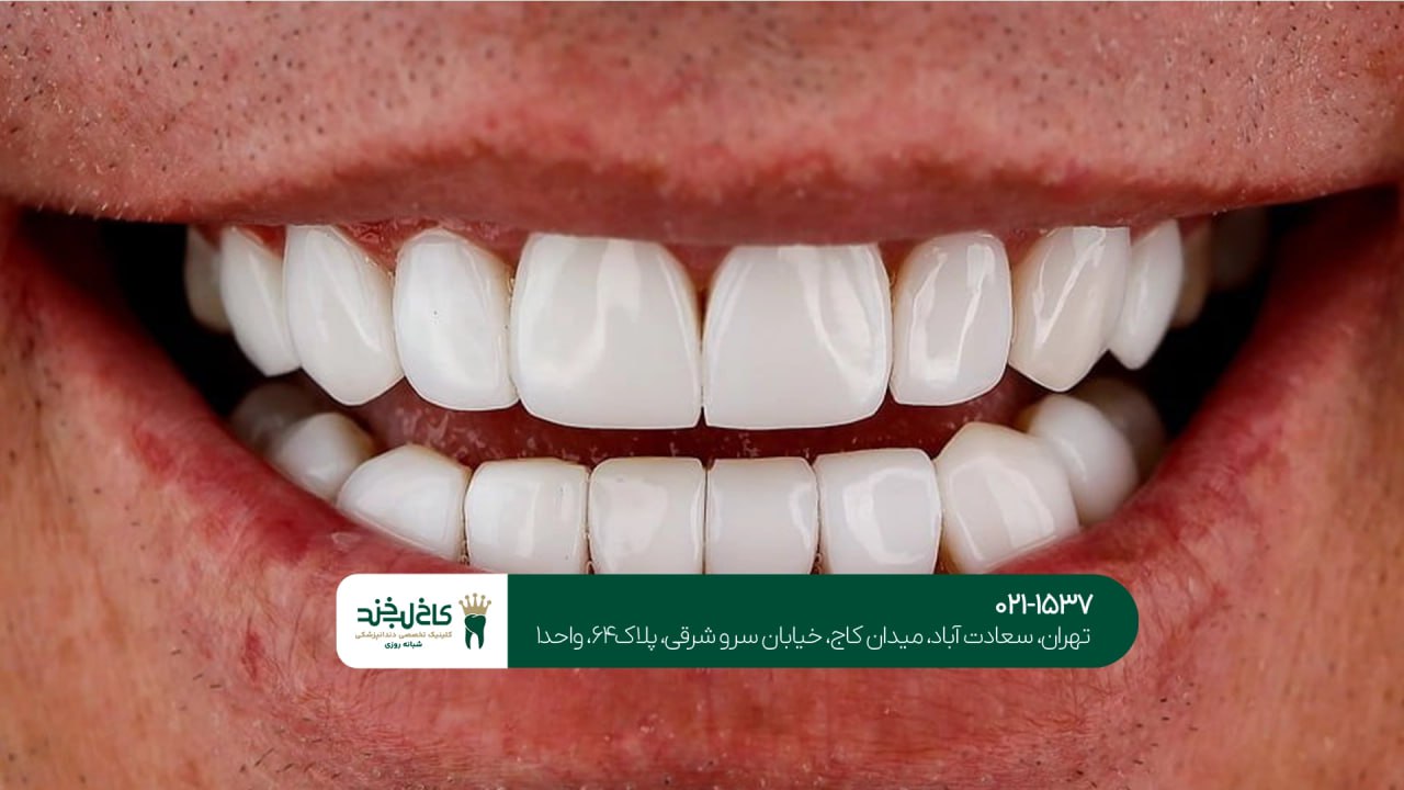 مرکز تخصصی کامپوزیت دندان