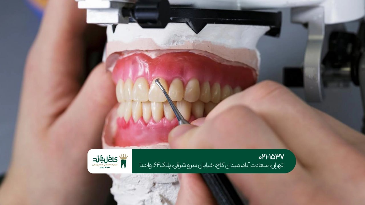 کلینیک دندان سازی تهران