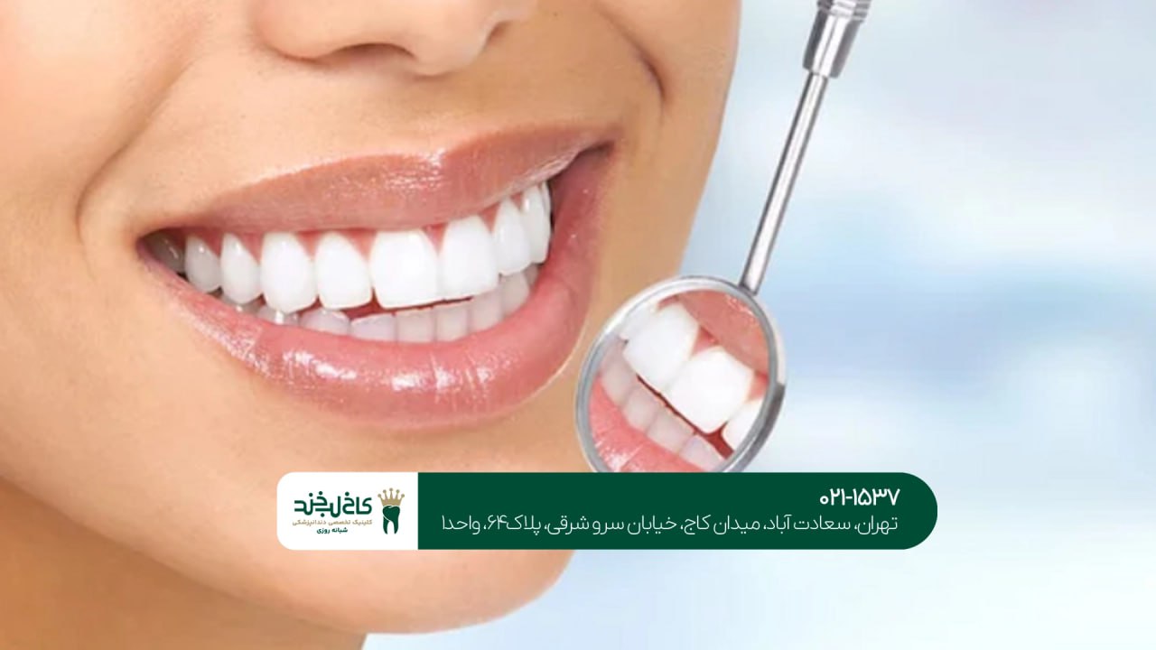 مراحل طراحی لبخند دیجیتال