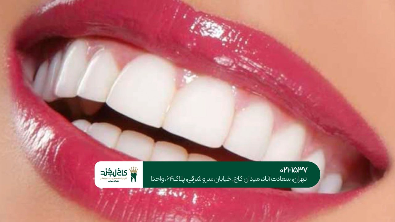 مرکز تخصصی زیبایی دندان