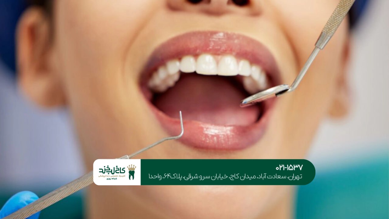 جرمگیری تخصصی دندان