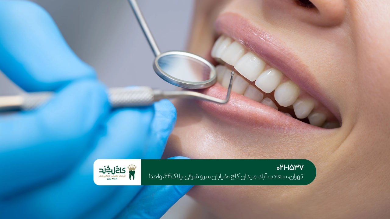 دندانپزشکی با پرداخت چکی