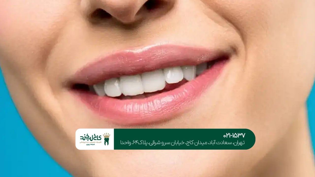 بهترین روش زیبایی دندان