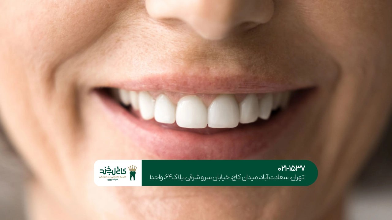 بهترین کلینیک ترمیم لبخند