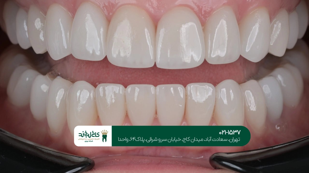 دندانپزشکی زیبایی مطمئن