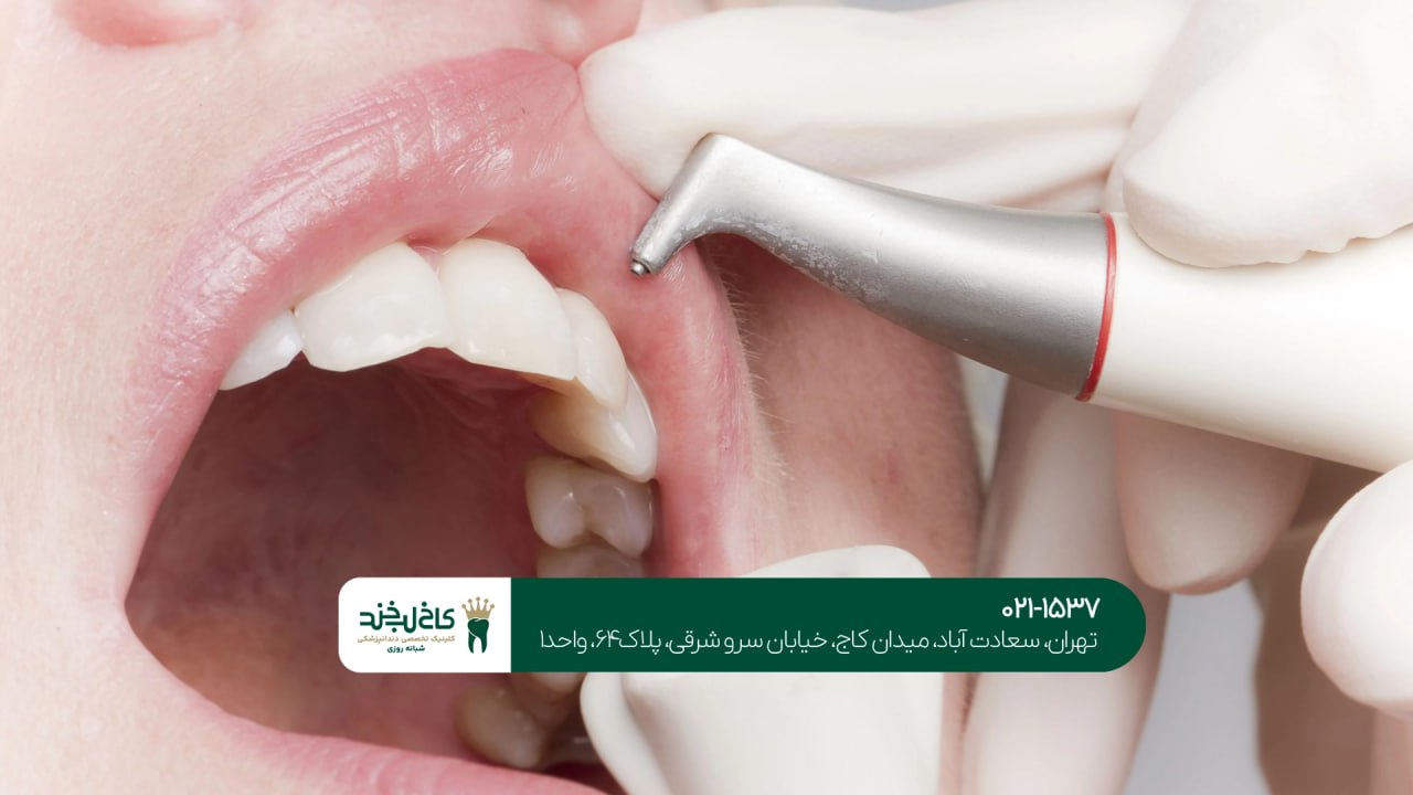 بهترین دندانپزشکی در تهران
