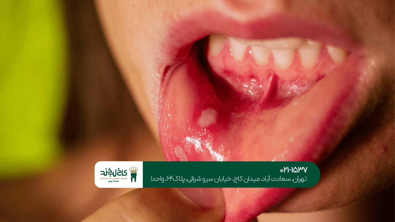 درمانهای ضد عفونی دهان و دندان