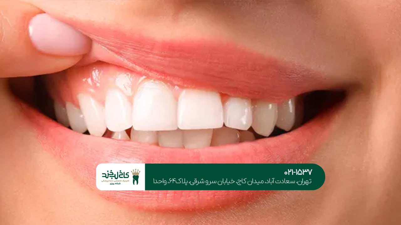 بهترین دندانپزشکی تخصصی زیبایی