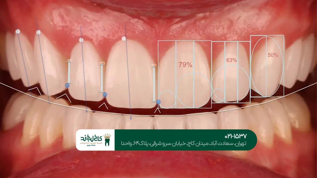 طراحی لبخند