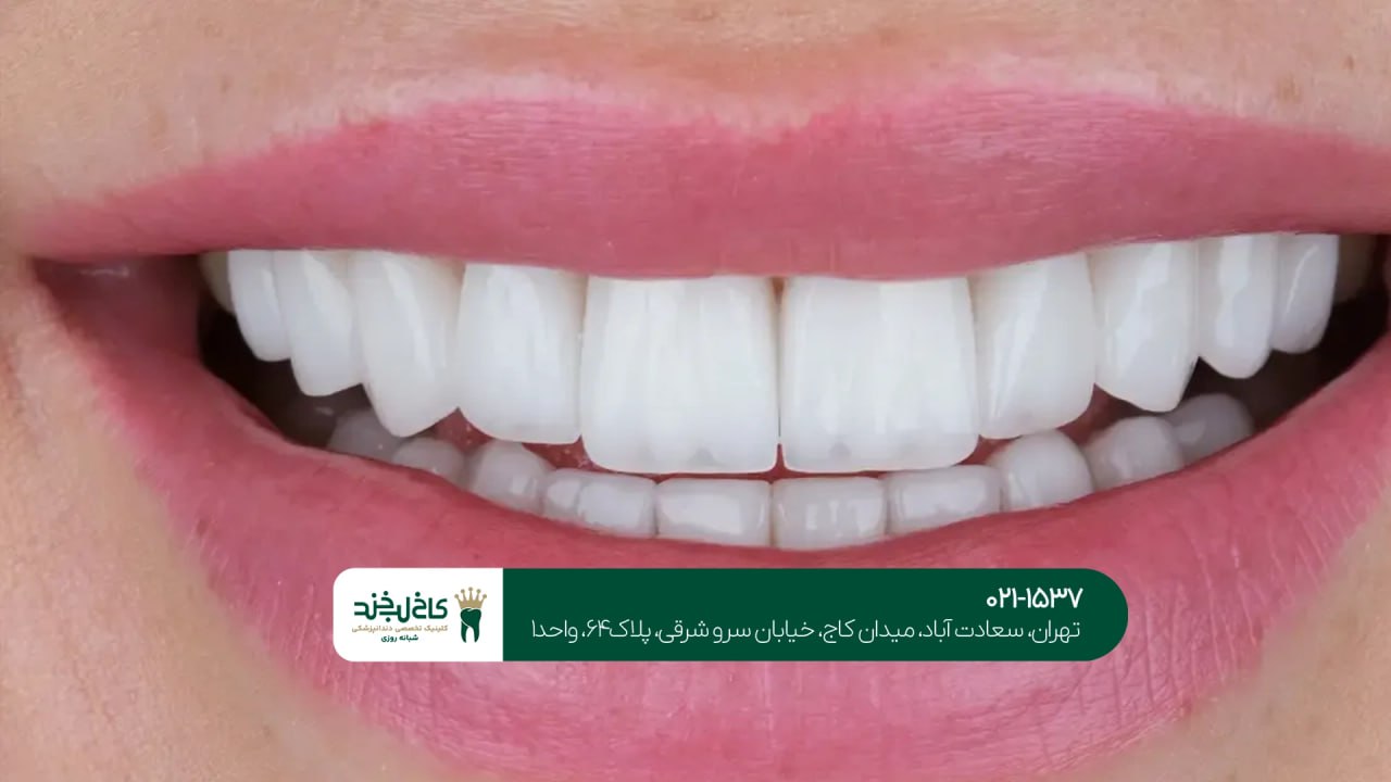 بهترین دندانپزشک زیبایی در تهران