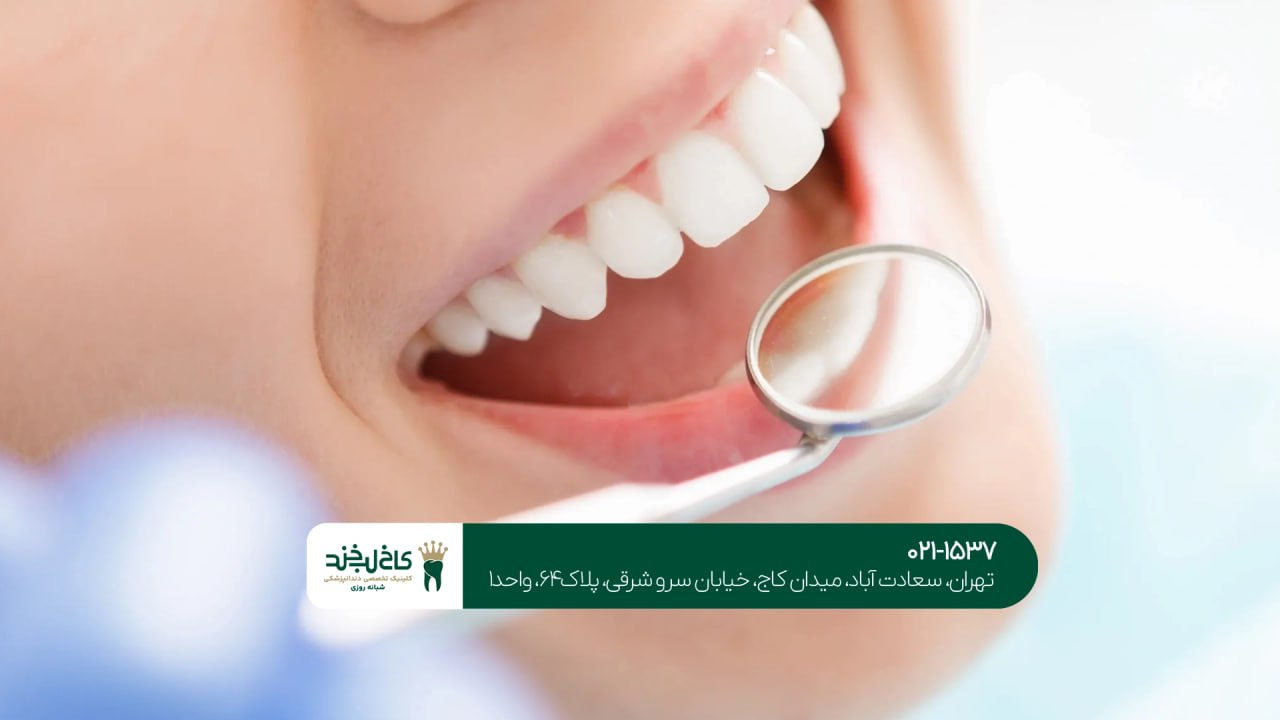 مشاوره زیبایی دندان تهران