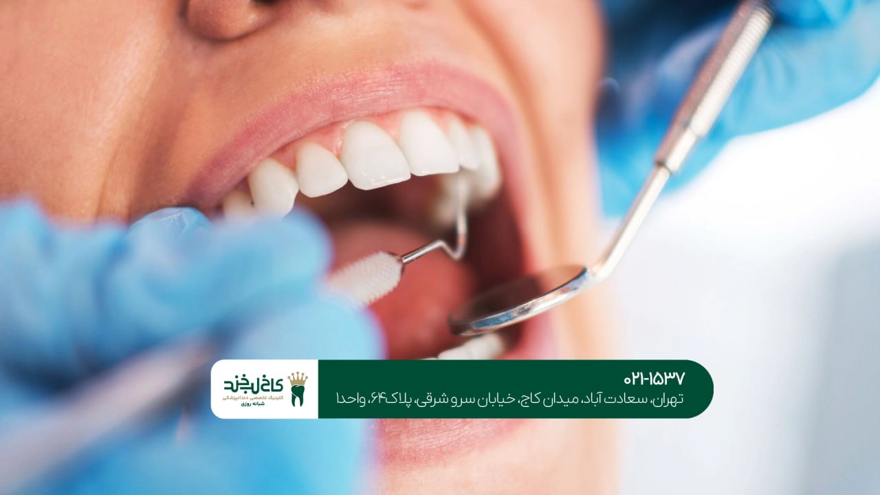 مشاوره دندانپزشکی تهران