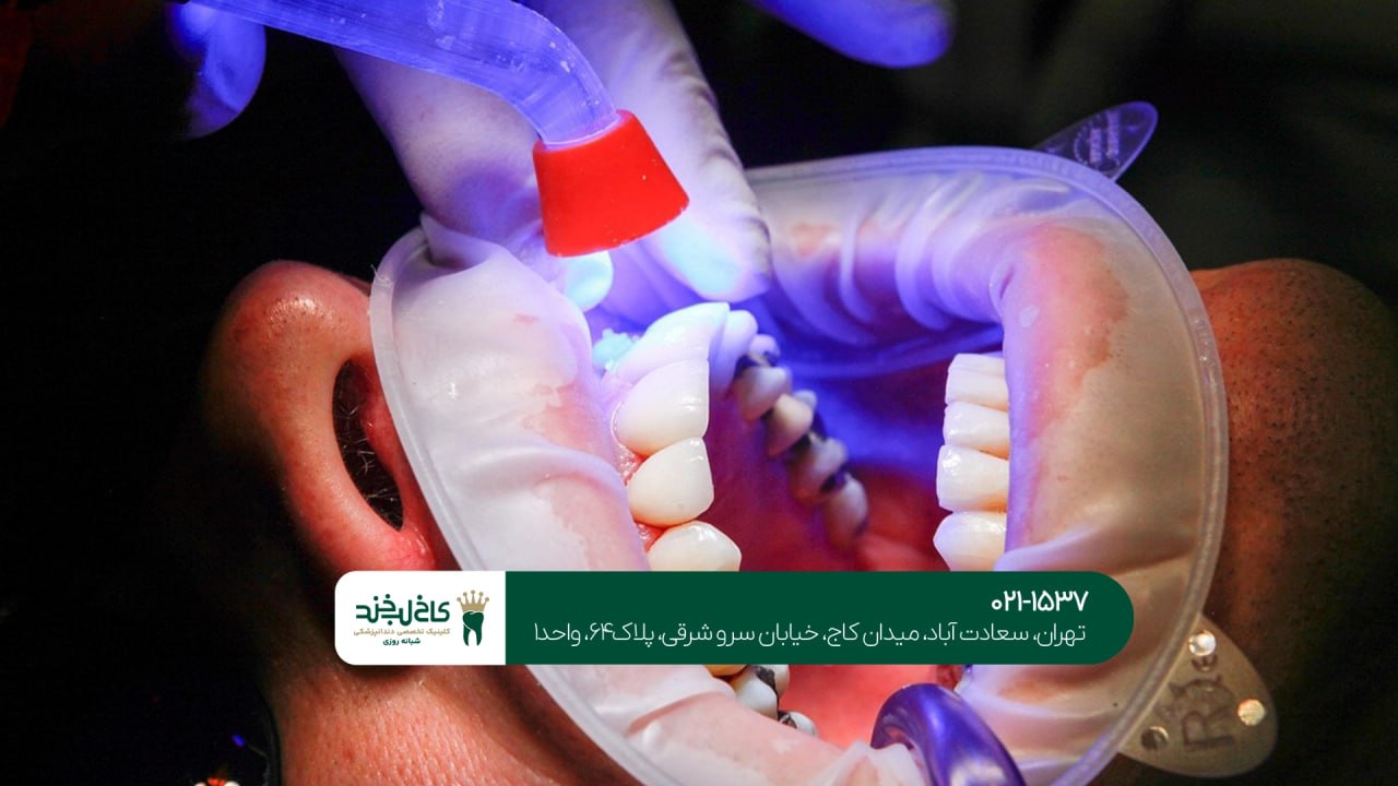 بهترین کلینیک کامپوزیت دندان