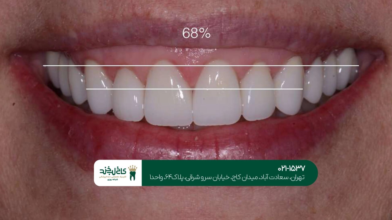 بهترین دندانپزشک طرح لبخند تهران