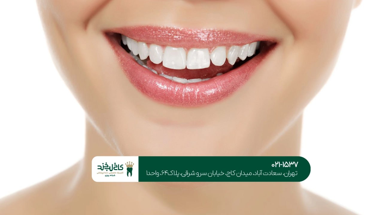 دندانپزشکی زیبایی در تهران