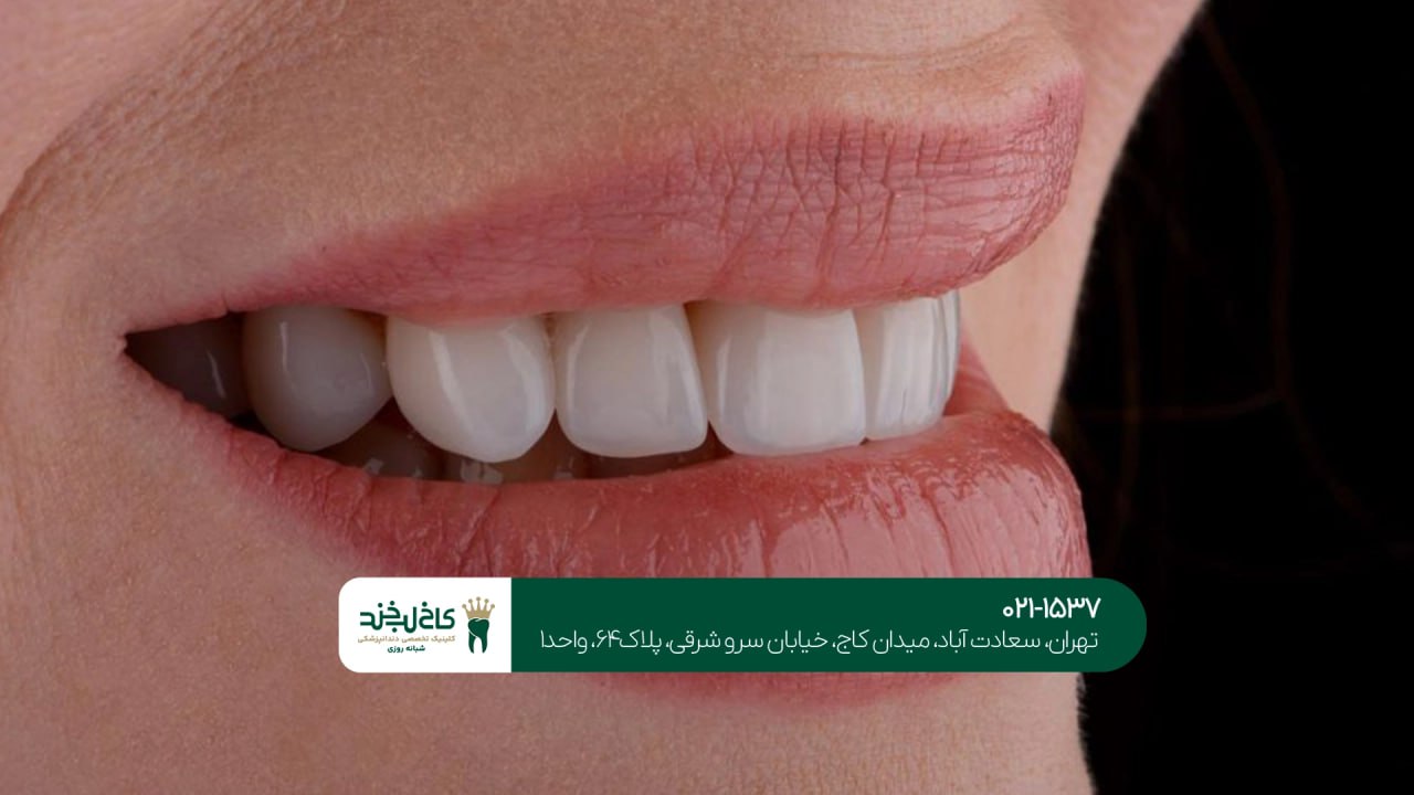 بهترین کلینیک طراحی لبخند