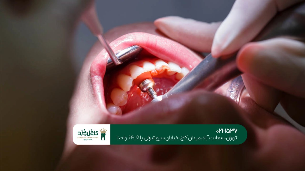 دندانپزشکی با قیمت مناسب در تهران