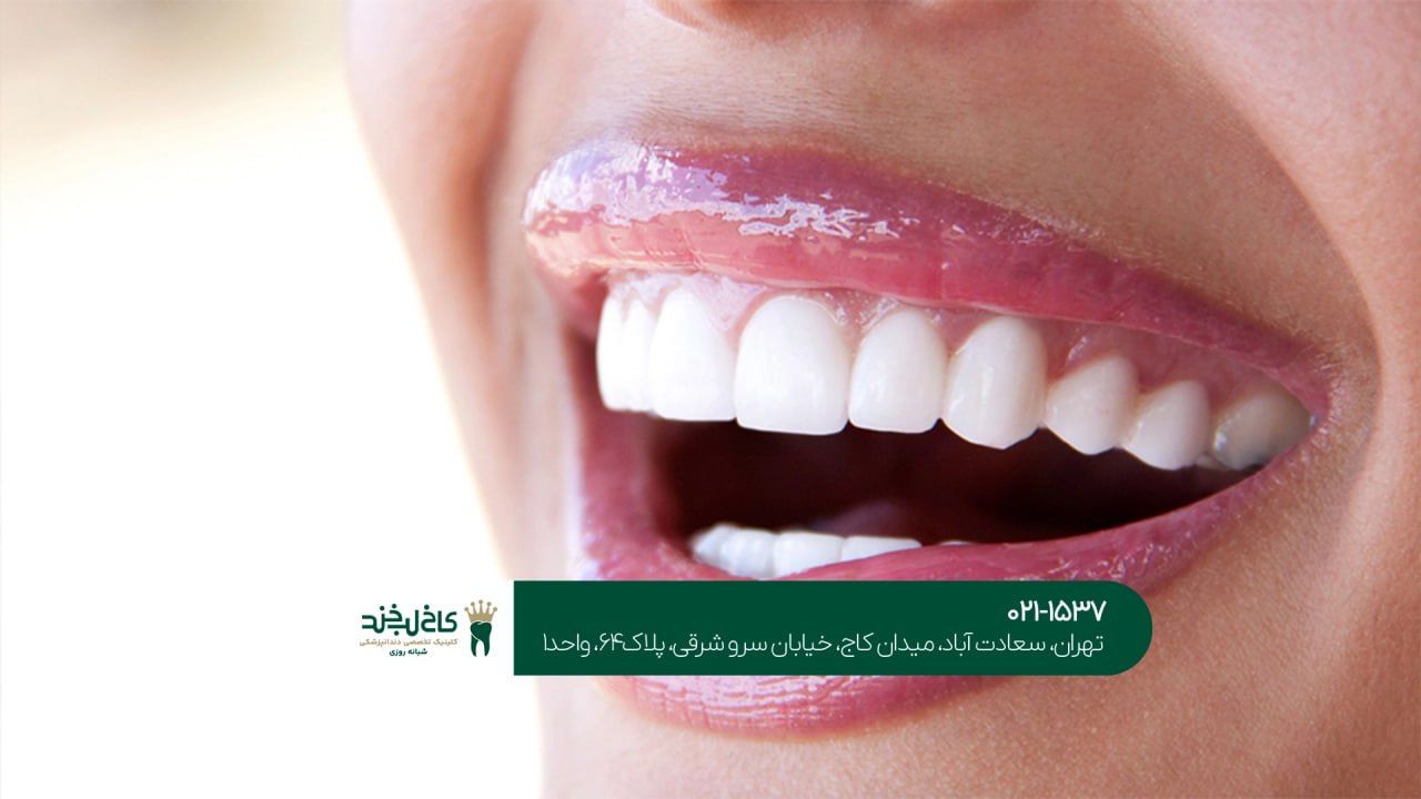 متخصص زیبایی لبخند