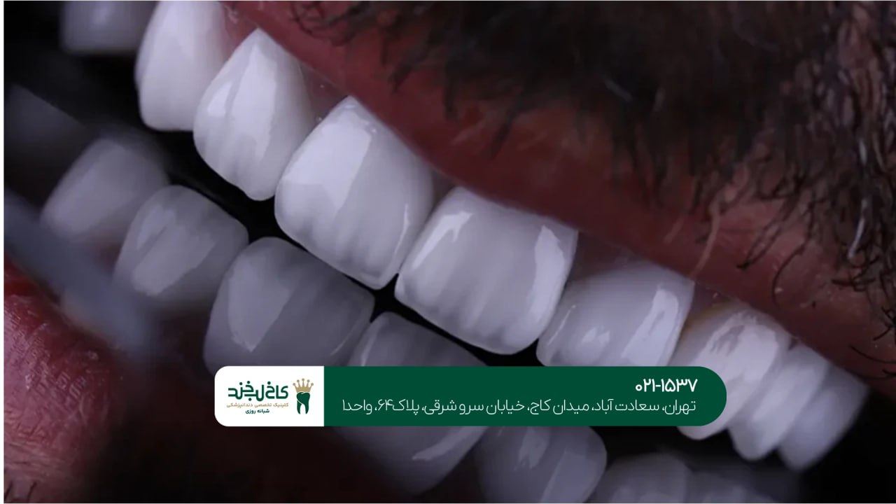 مرکز تخصصی کامپوزیت دندان
