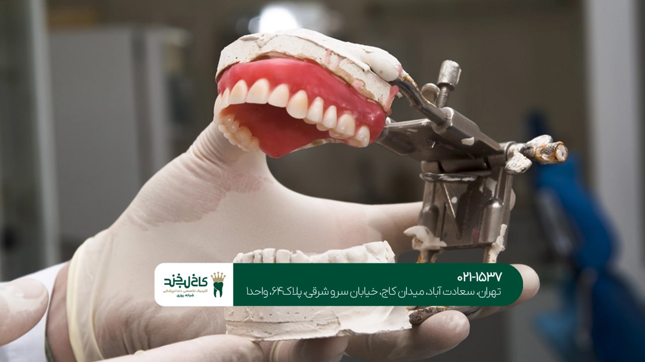 کلینیک دندان سازی تهران