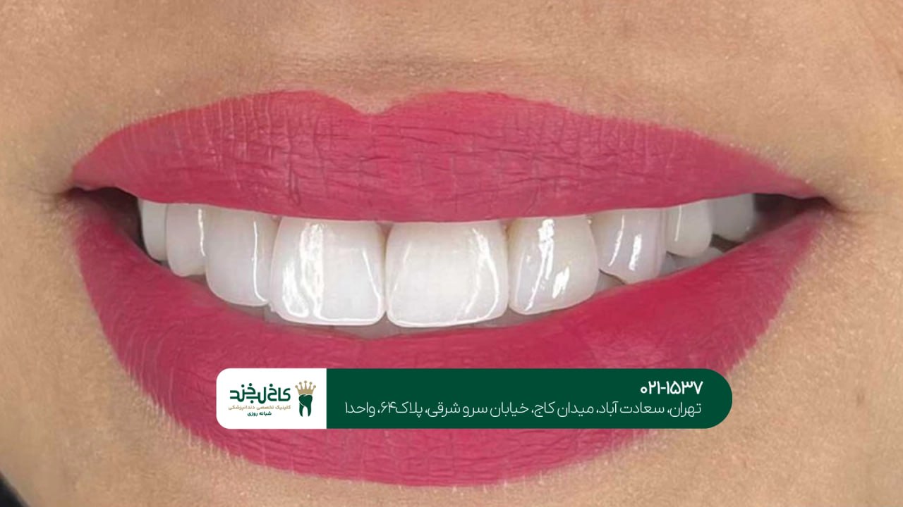 مرکز تخصصی زیبایی دندان