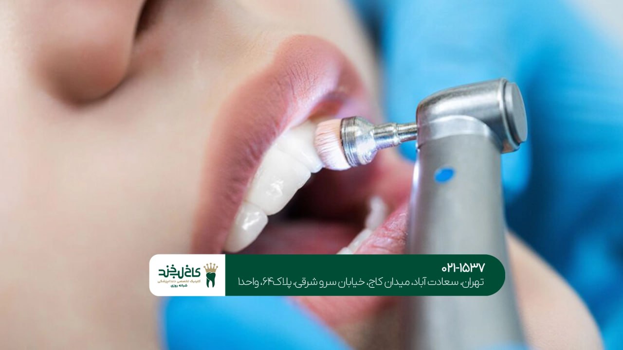 دندانپزشکی با پرداخت چکی