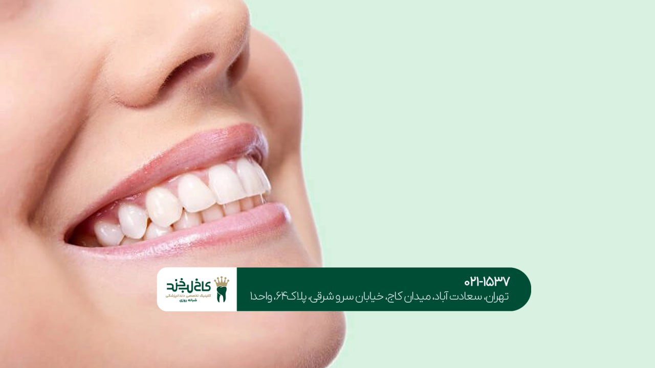بهترین کلینیک ترمیم لبخند