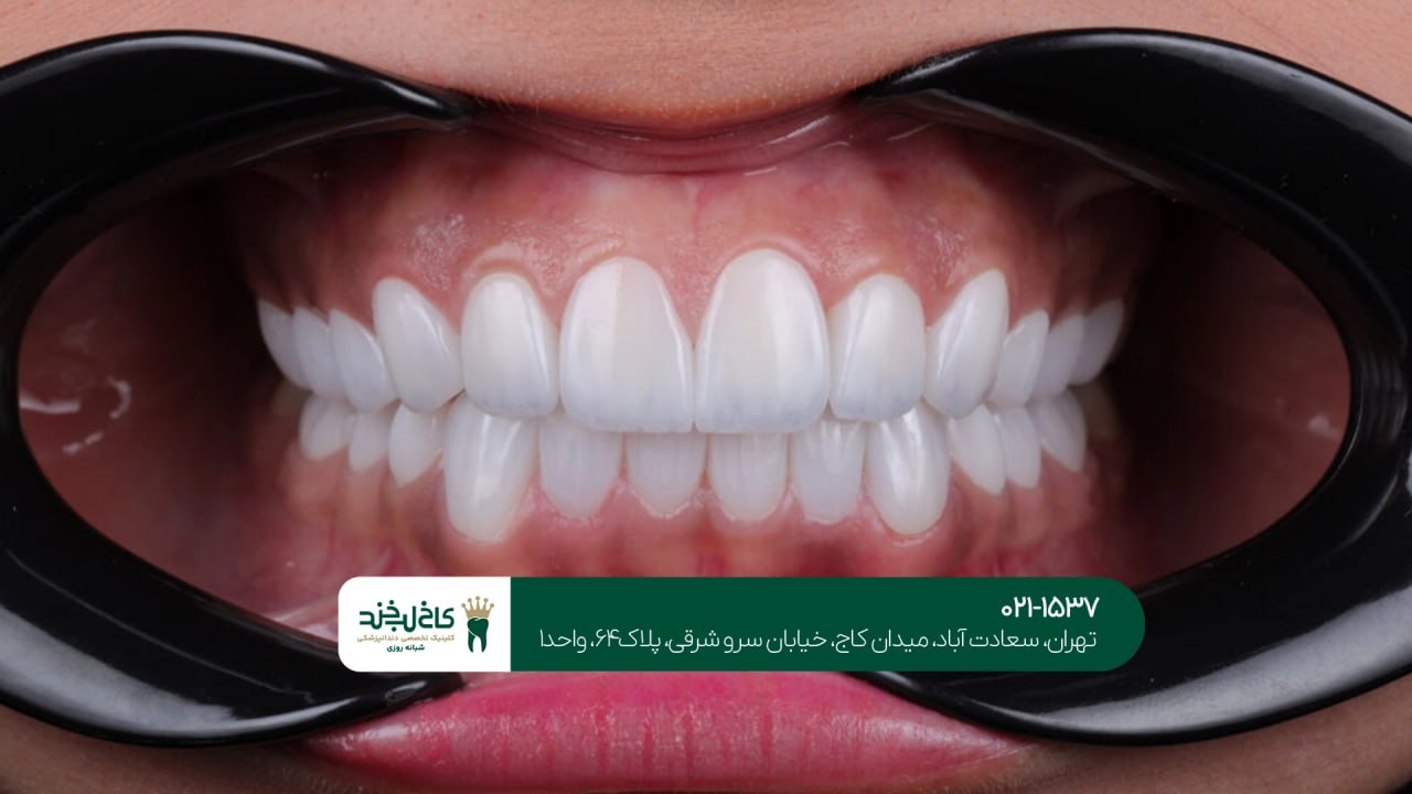 دندانپزشکی زیبایی مطمئن