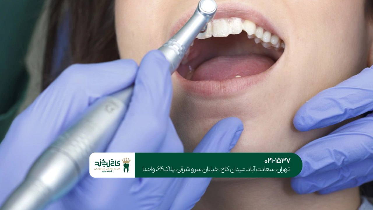 بهترین متخصص زیبایی دندان