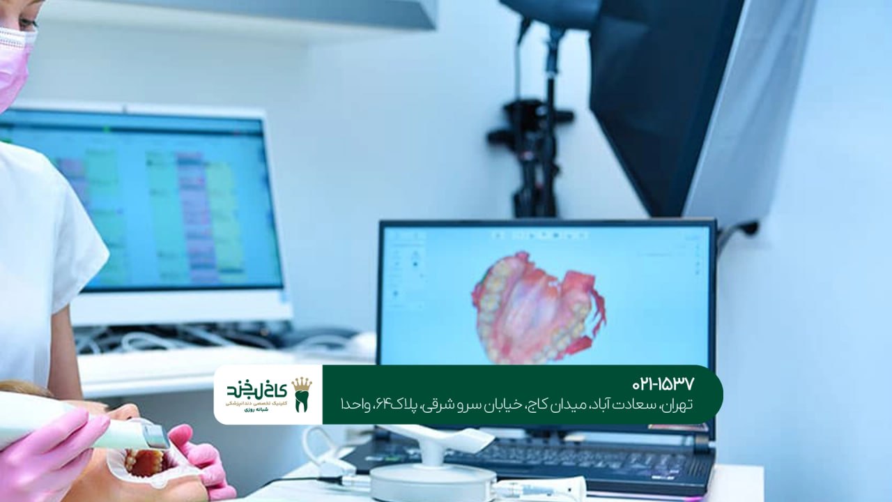 قالبگیری دیجیتال