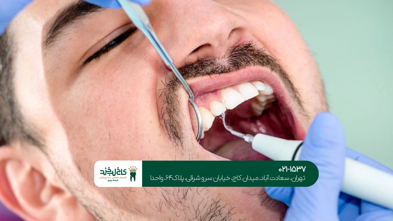 آیا جرمگیری به دندان آسیب می زند؟