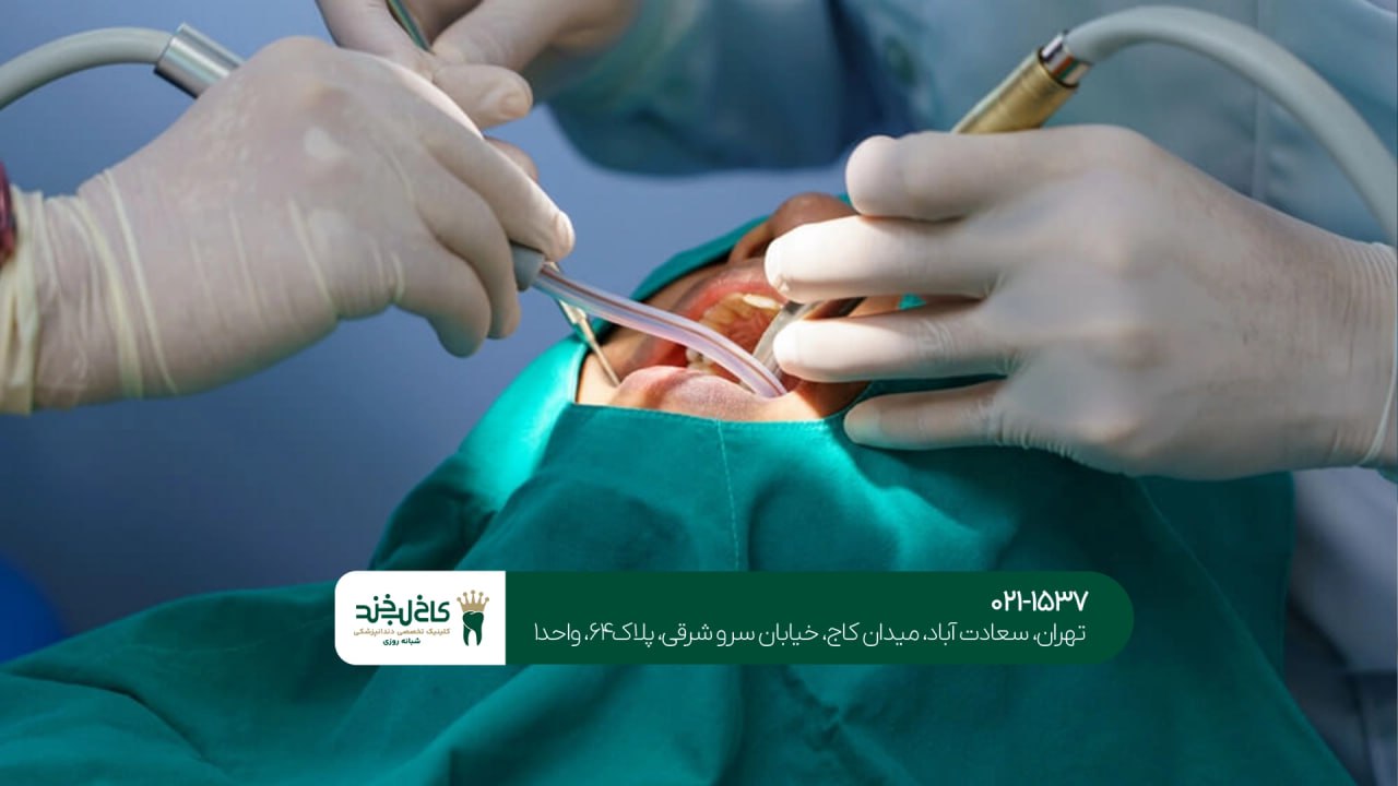 درمان فک و صورت