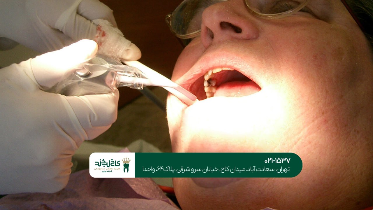 درمان سرطان دهان و دندان