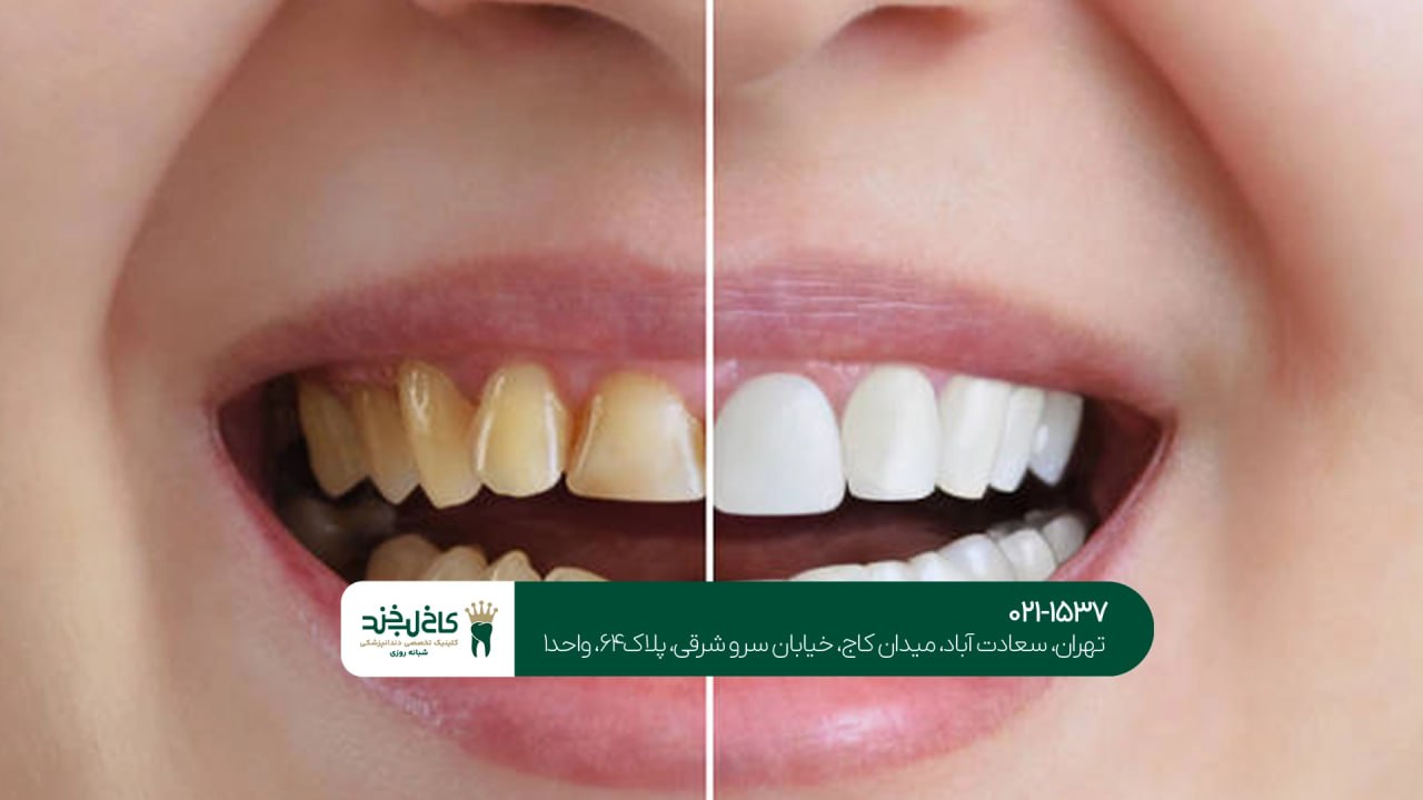 بهترین دندانپزشکی تخصصی زیبایی