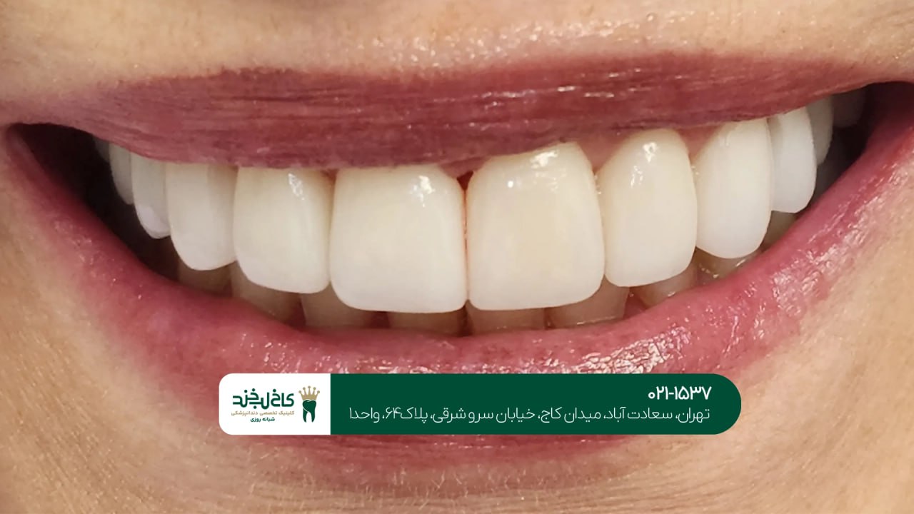 بهترین دندانپزشک زیبایی در تهران