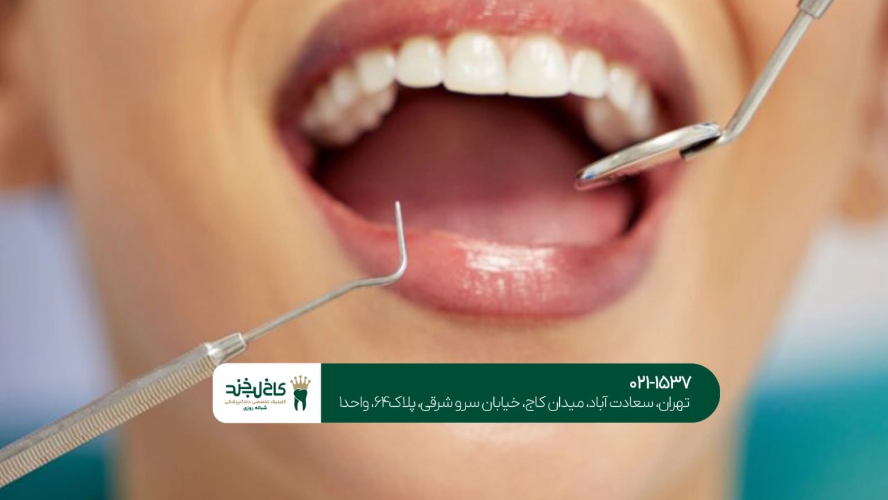 مشاوره دندانپزشکی تهران