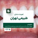 لمینت دندان طبیعی در تهران