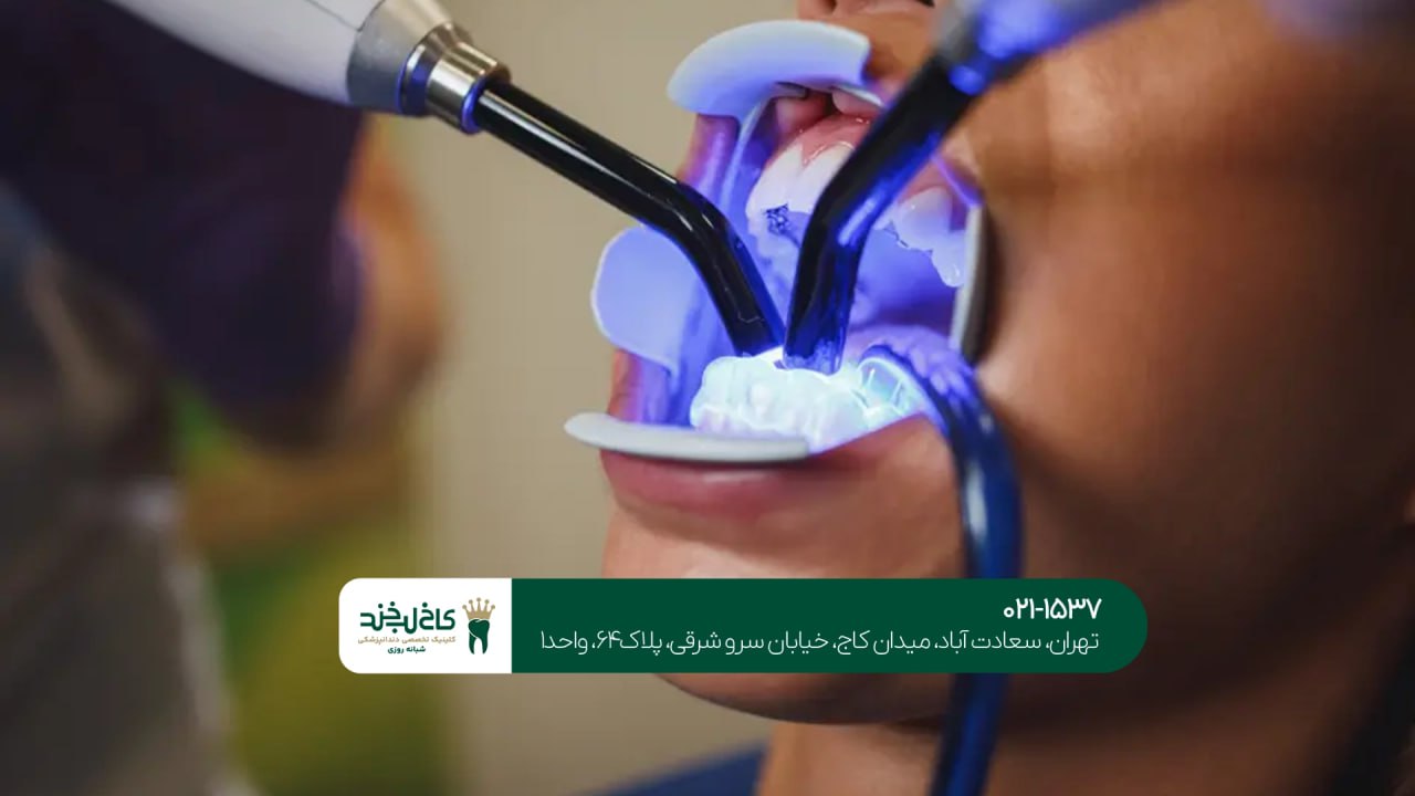 بهترین کلینیک کامپوزیت دندان