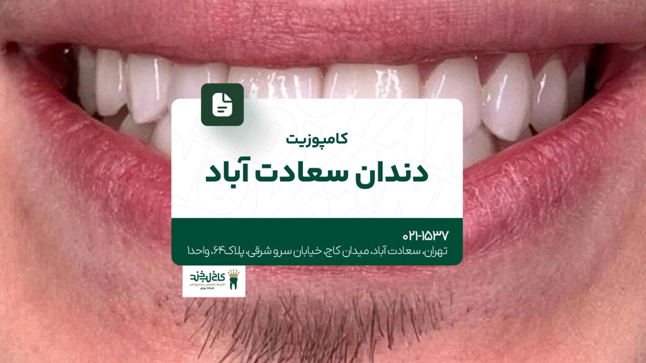 کامپوزیت دندان سعادت آباد