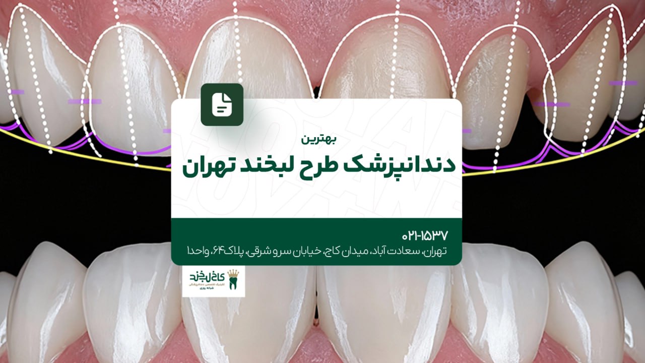 بهترین دندانپزشک طرح لبخند تهران