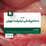 بهترین دندانپزشکی ایمپلنت تهران