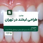 بهترین طراحی لبخند در تهران