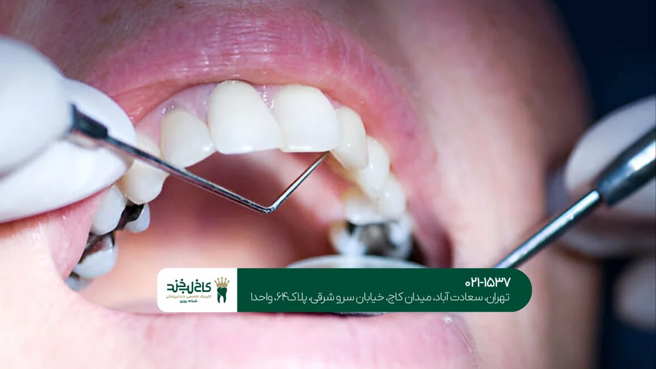 دندانپزشکی با قیمت مناسب در تهران