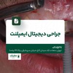 جراحی دیجیتال ایمپلنت
